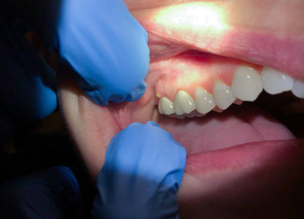 Best 24-Hour Emergency Dental Care in Rson, CA