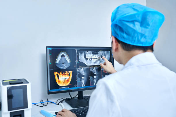 Best Emergency Dental Care for Sports Injuries in Rson, CA