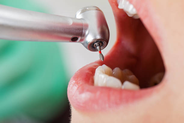 Best 24-Hour Emergency Dental Care in Rson, CA